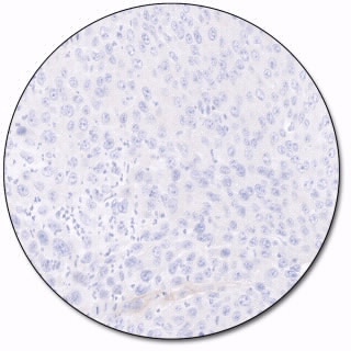 PD-L1 IHC 28-8 pharmDx for Autostainer Link 48